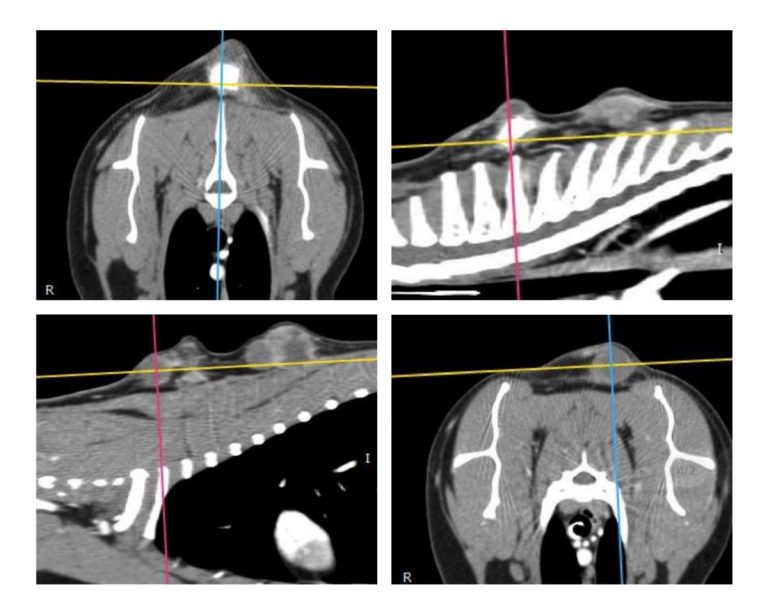 injekció okozta szarkóma CT