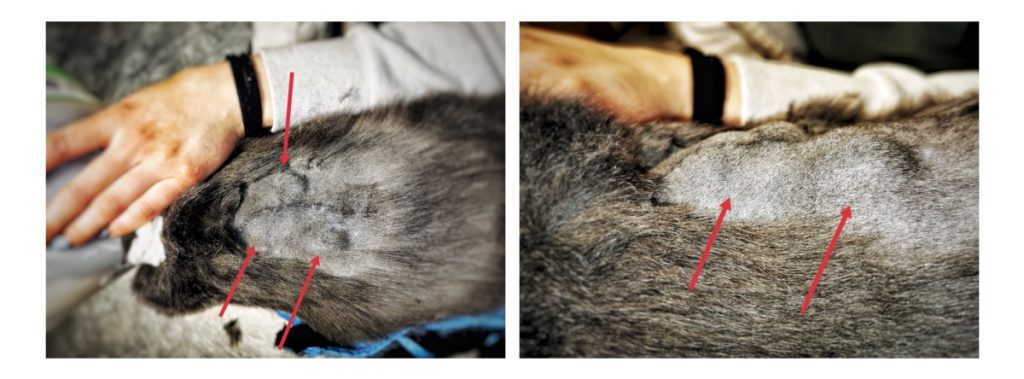 injekció okozta szarkóma