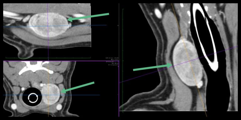 kutyapajzsmirigy daganat CT
