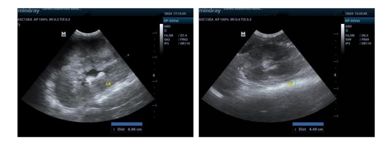 lymphomás vese ultrahang