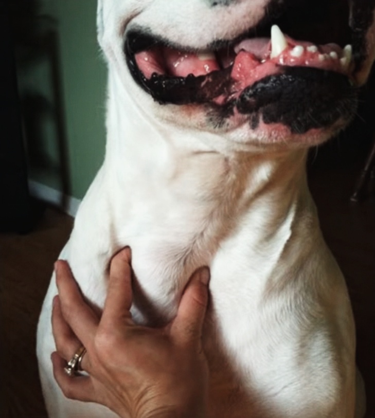 megnagyobbodott pajzsmirigy