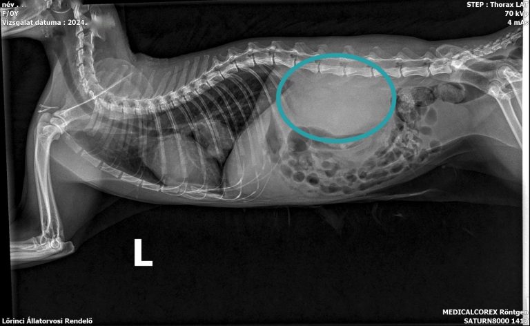 megnagyobodott vese RTG