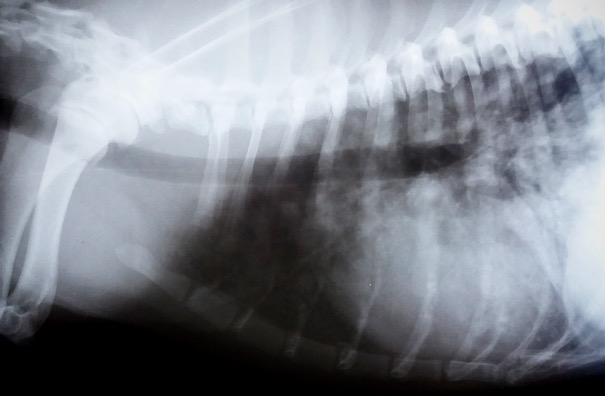 Tüdőáttét röntgen felvétele