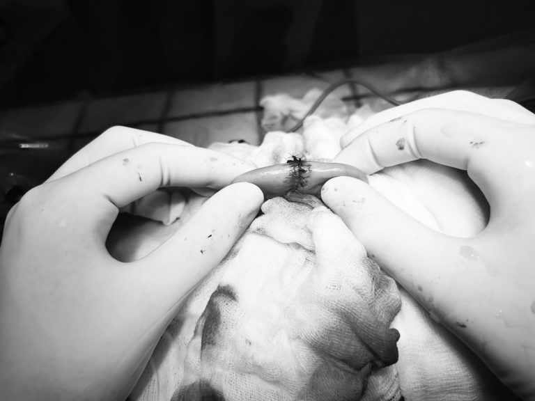 vékonybél biopszia után